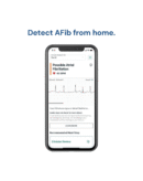 AliveCor Single Lead ECG Device - Fast & Accurate