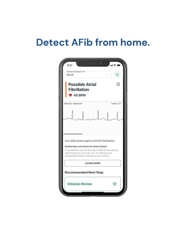 AliveCor Single Lead ECG Device - Fast & Accurate - Image 4