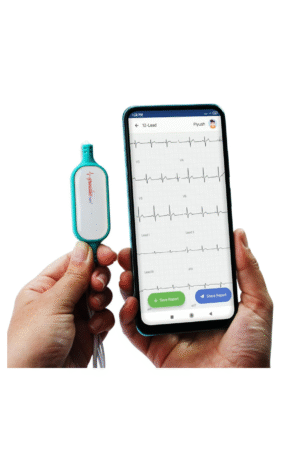 Sunfox Spandan Neo Portable ECG Machine