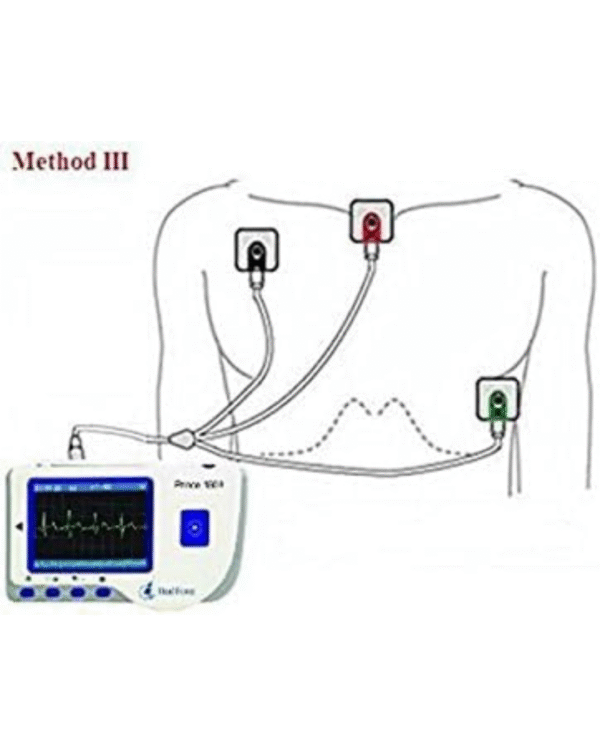 Heal Force Prince 180B Portable ECG Monitor Continuous Measuring with 3-Lead ECG Cable and Electrodes - Image 3