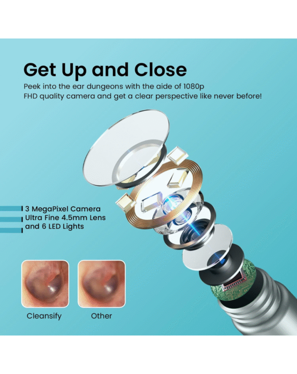 Portronics Cleansify Ear Endoscope Otoscope/Wax Cleaner with 1080p FHD Camera with Ultra fine 4.5mm Lens - Image 2