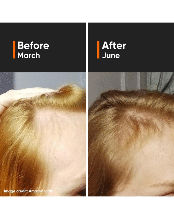 Minimalist Hair Growth Serum With 3% Redensyl, 3% Anagain, 3% Procapil, 5% Capixyl & 4% Baicapil 18% Hair Growth Actives - Image 2