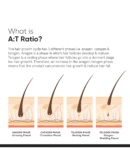 Minimalist Hair Growth Serum With 3% Redensyl, 3% Anagain, 3% Procapil, 5% Capixyl & 4% Baicapil 18% Hair Growth Actives