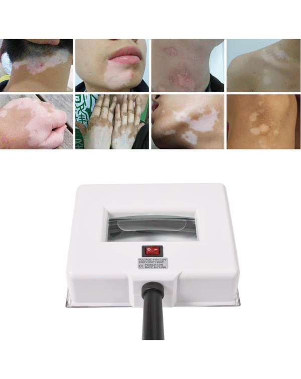 Dr. pen ® Wood Lamp Skin Analyzer | Skin Testing Beauty Equipment - Image 4