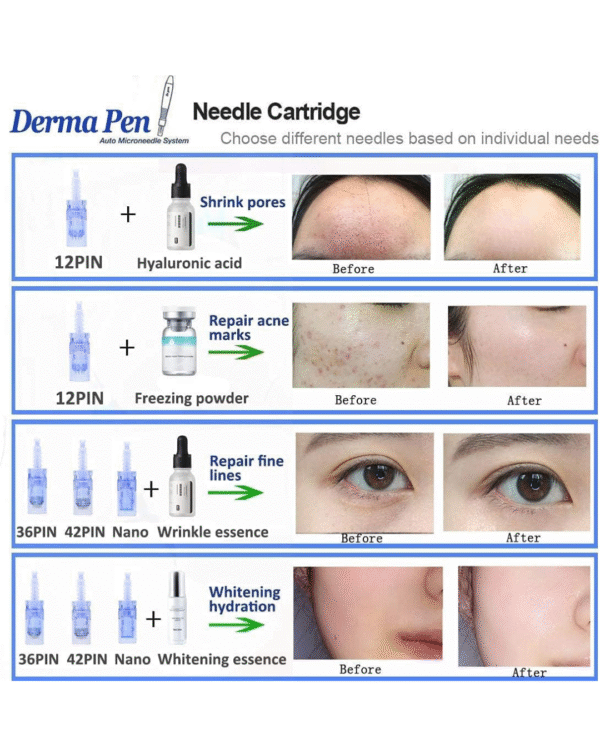 Dermapen Dr.Pen Ultima A6 Microneedle Pen Electric Derma Roller Pen with 12PIN 36PIN Nano Round Cartridges Needles Wrinkle Stretch Marks Scar Hair Loss Treat 0.25-2.5mm Adjustable - Image 4