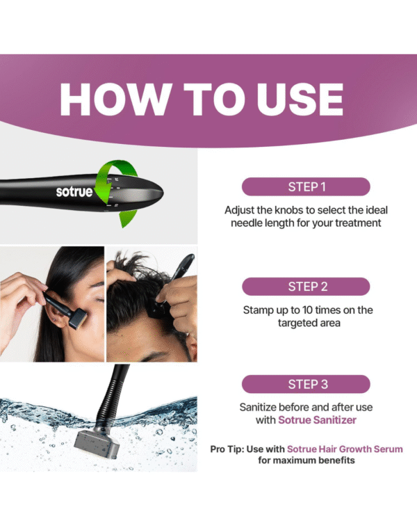Sotrue Derma Stamp with Sanitizer for Hair Growth | Titanium Coated Adjustable Needles 0.25mm to 3mm - Image 3