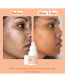 WishCare Super Bright C16 Vitamin C Serum