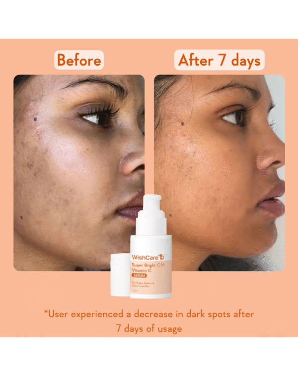 WishCare Super Bright C16 Vitamin C Serum - Image 3