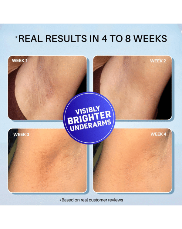 DermDoc 5% Glycolic Acid Underarm Brightening Spray Treatment (100 Ml) - Image 3