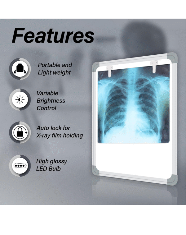 OTICA LED X-Ray View Box Fully Automatic for Hospital with Variable Brightness Control (Extra Bright LED) - Image 3