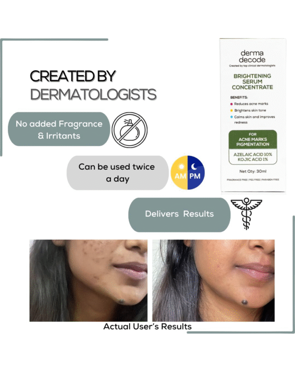 Derma Decode Azelaic Acid Serum with 10% Azelaic Encapsulated, 1% Kojic Acid - Image 2