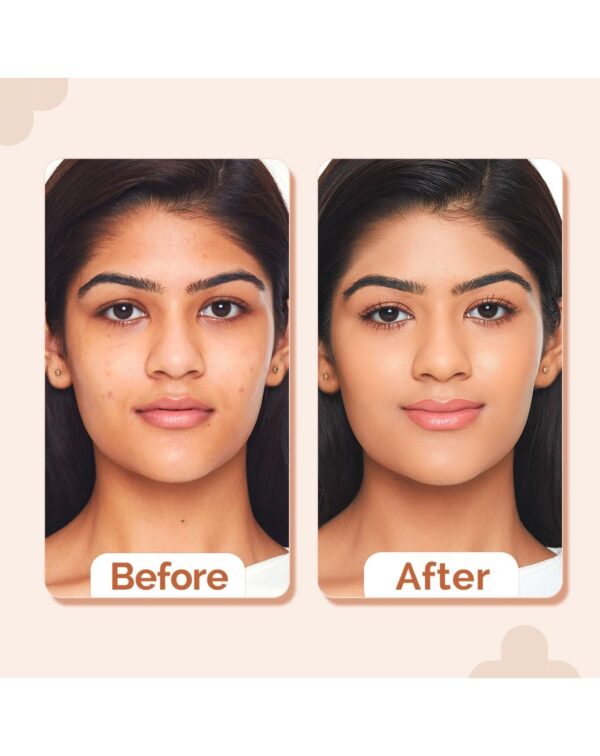 The Derma Co 2% Niacinamide High Coverage Matte Finish Foundation With 1% Hyaluronic Acid & Spf 40 Pa+++ - Image 3