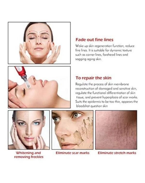 Derma Pen with 2 Extra 12 Needles Cartridges Derma Pen | Mesopen for Anti Aging - Image 3
