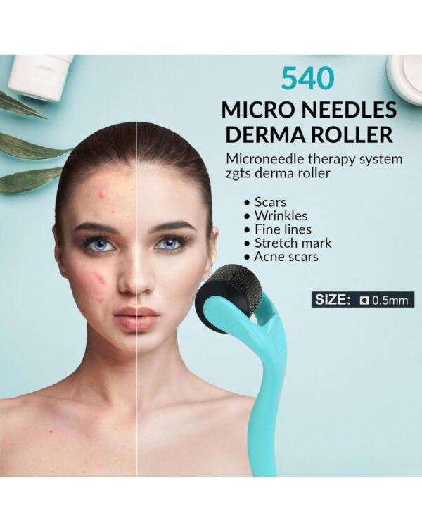 GLUN® Full Body Acupressure Derma Roller, 540 Golden Titanium Micro Needles Cosmetic Device for Face Beauty - Image 3