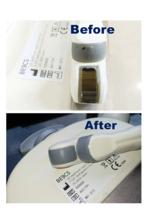 Service For Endocavity [TV] Acoustic Lens Replacement