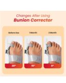 AGEasy Antara Bunion Corrector Adjustable Toe Straightener for Men & Women